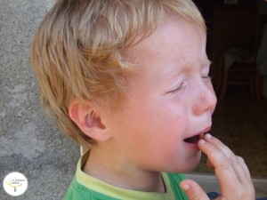 accidentes en niños, quemaduras en niños, dolor en quemaduras, quemaduras en niños remedios caseros