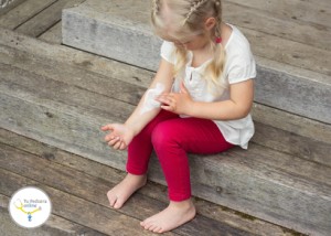 Girl applying cream on allergic skin, eczema treatment