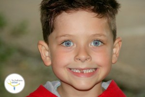 azúcar-y-caries-azúcar-y-dientes-de-leche-caries-caries-del-biberón-caries-en-dientes-de-leche-caries-en-niños