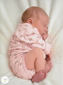 pies planos en bebes, Pie talo, metatarso aducto, metatarso varo, pie zambo y pie plano