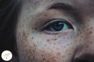pecas y lunares en niños, niños con lunares, mi hijo tiene pecas, tu pediatra online