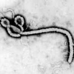 ebola efectos y tratamiento pediatra en linea