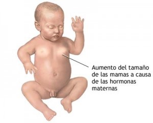 pecho inflamado en recién nacidos y bebes, hinchazón de las glándulas mamarias en el recién nacido, desarrollo de senos en bebes